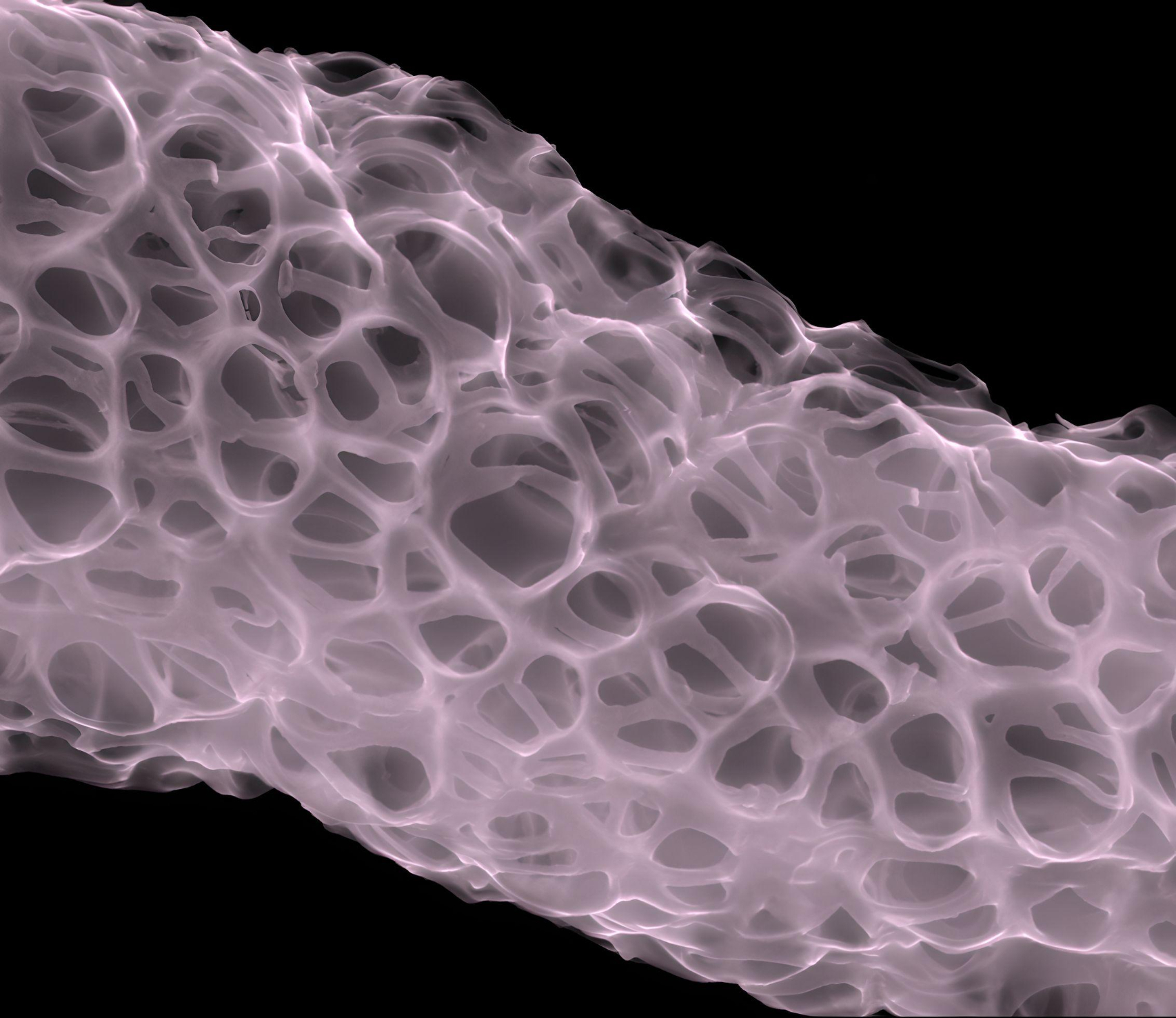Medical electrospinning illustration.